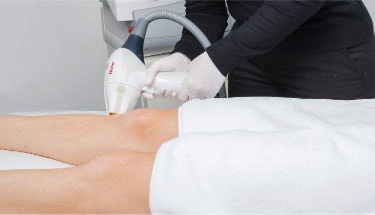 a woman receiving laser hair removal on her leg